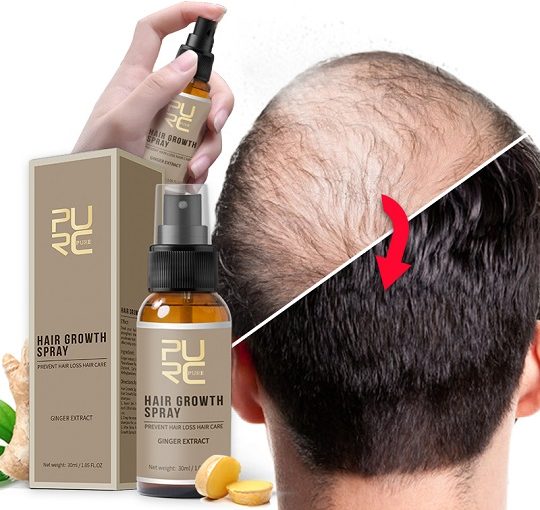 Hair Growth Oil Spray | matnahanquoc